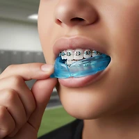 Shock Doctor Youth Braces Mouth Guard
