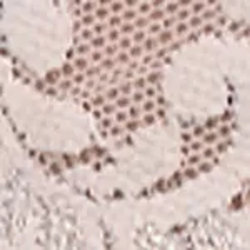 Retro Lace Vikini - 9K2124