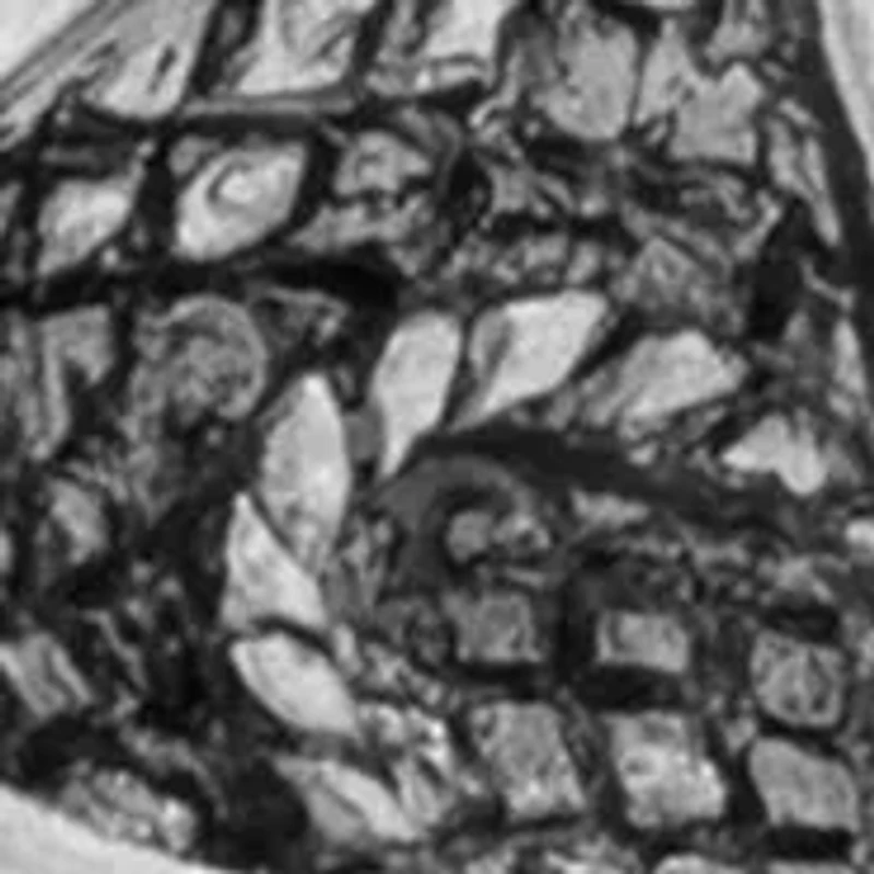 Lacrosse Sticks Cufflinks