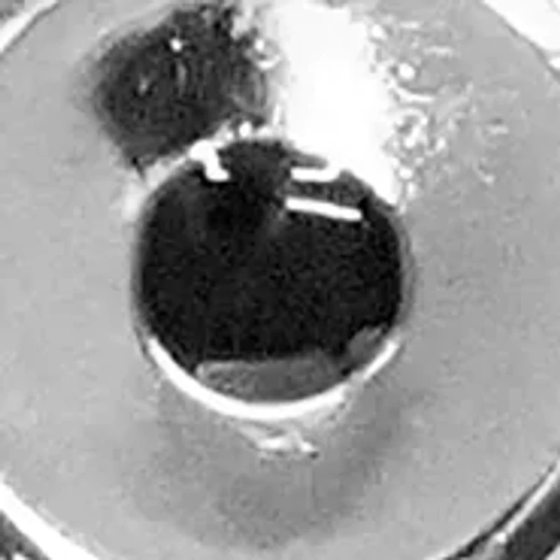 Silver Collar Extenders