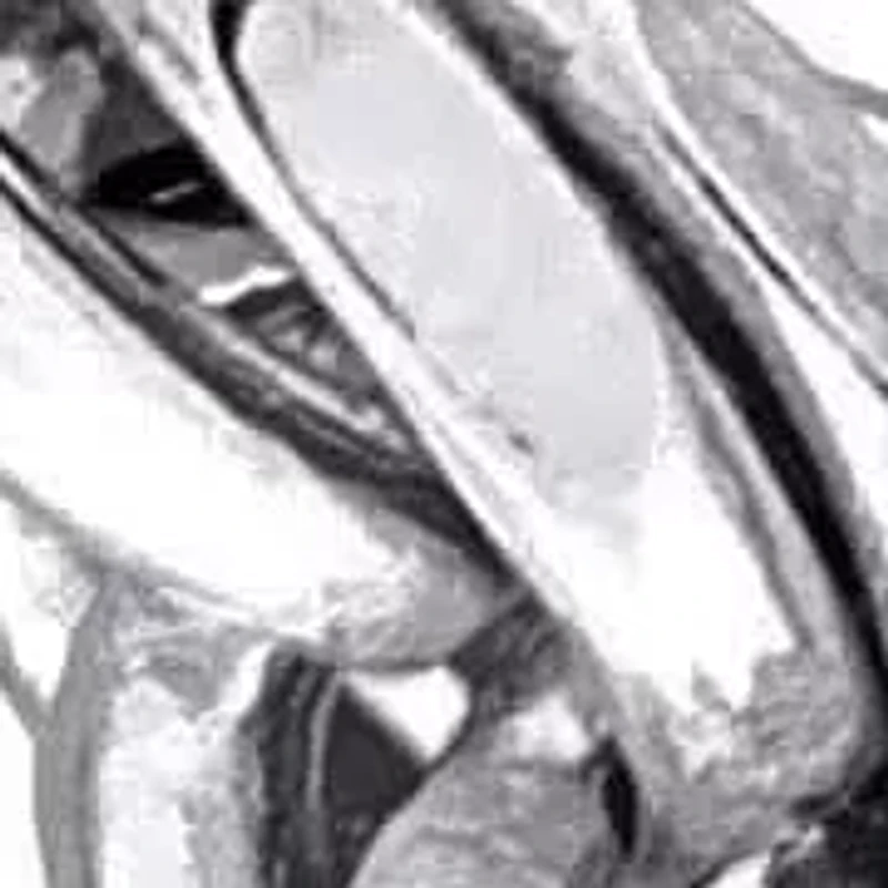 2.9mm Diamond Cut Rope Chain Necklace