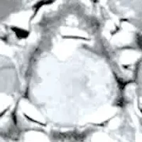 1/8 Cttw. Diamond Two-Tone Gold-Plated Silver Oval-Shaped Engagement Ring