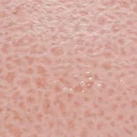  Crocograin Pattern Pink Strap Watch