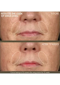 Plantscription™ Active Wrinkle Correction Serum with Retinoid