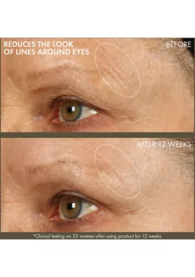 Plantscription™ Active Wrinkle Correction Serum with Retinoid