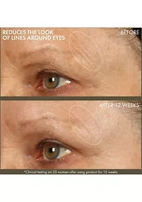 Plantscription™ Active Wrinkle Correction Serum with Retinoid