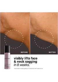 ultimate miracle worker lift & firm face & neck serum - 1.6 oz