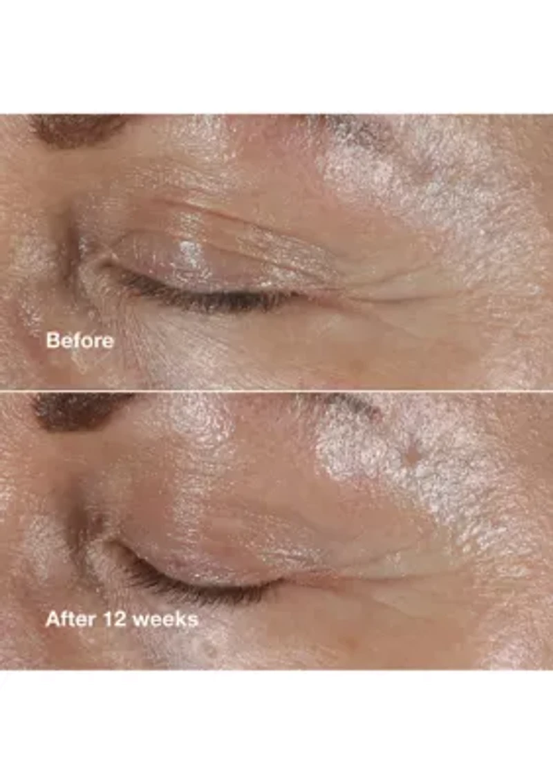 Smart Clinical Repair™ Wrinkle Correcting Eye Cream