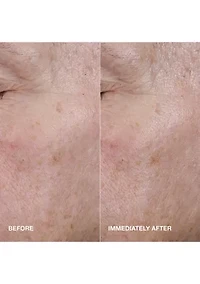 Moisture Surge™ Active Glow Serum with Hyaluronic Acid