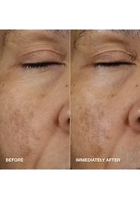 Moisture Surge™ Active Glow Serum with Hyaluronic Acid