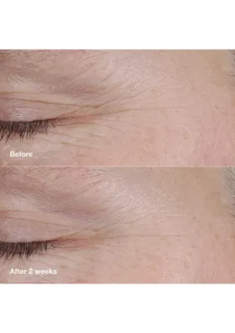 Smart Clinical Repair™ AM/PM Retinoid Balm 
