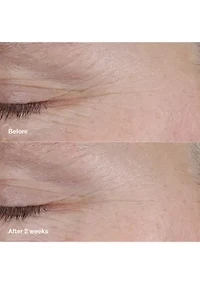 Smart Clinical Repair™ AM/PM Retinoid Balm 