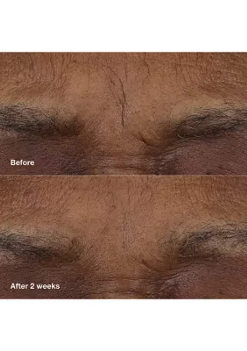 Smart Clinical Repair™ AM/PM Retinoid Balm 