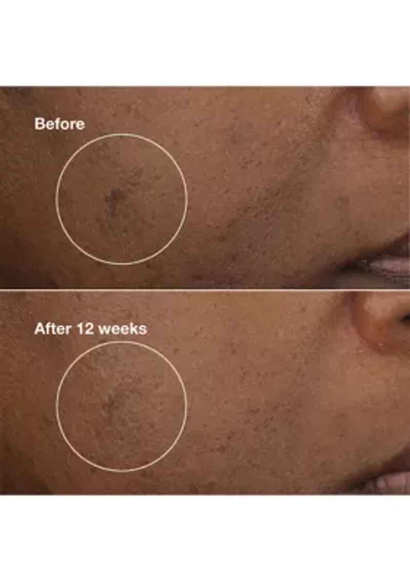 Even Better Clinical™ Brightening Moisturizer