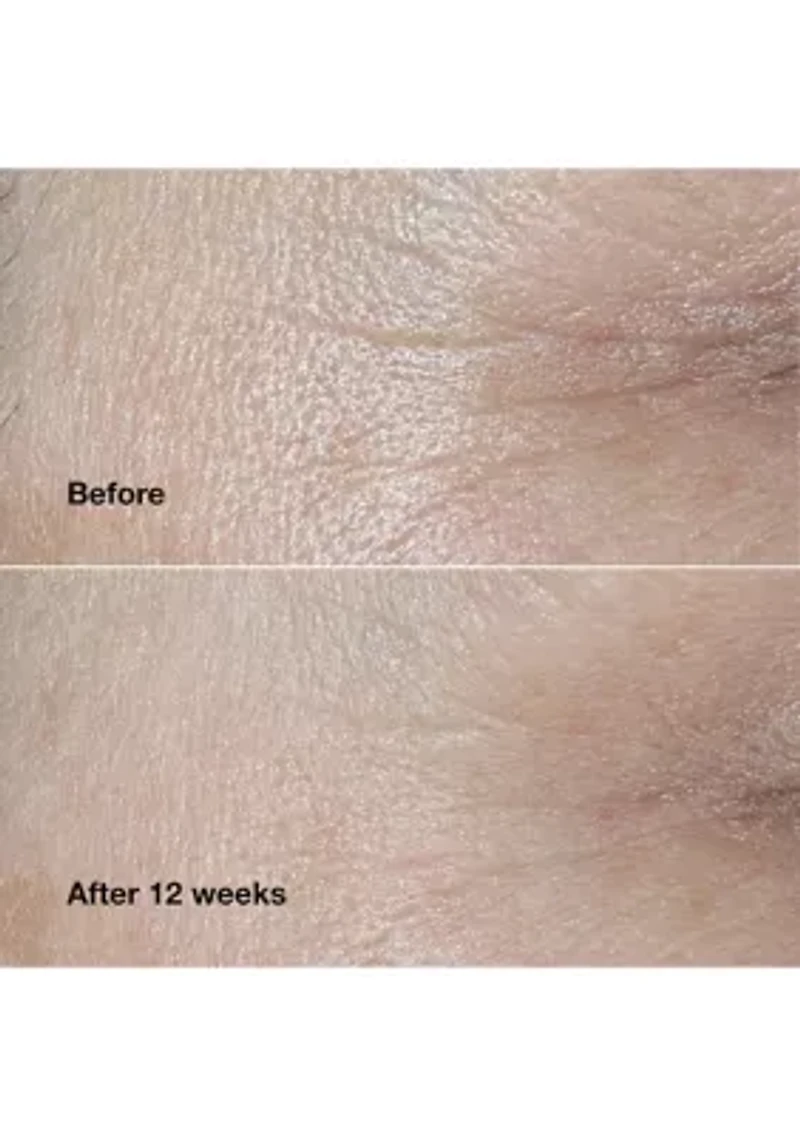 Smart Clinical Repair™ Wrinkle Correcting Face Cream