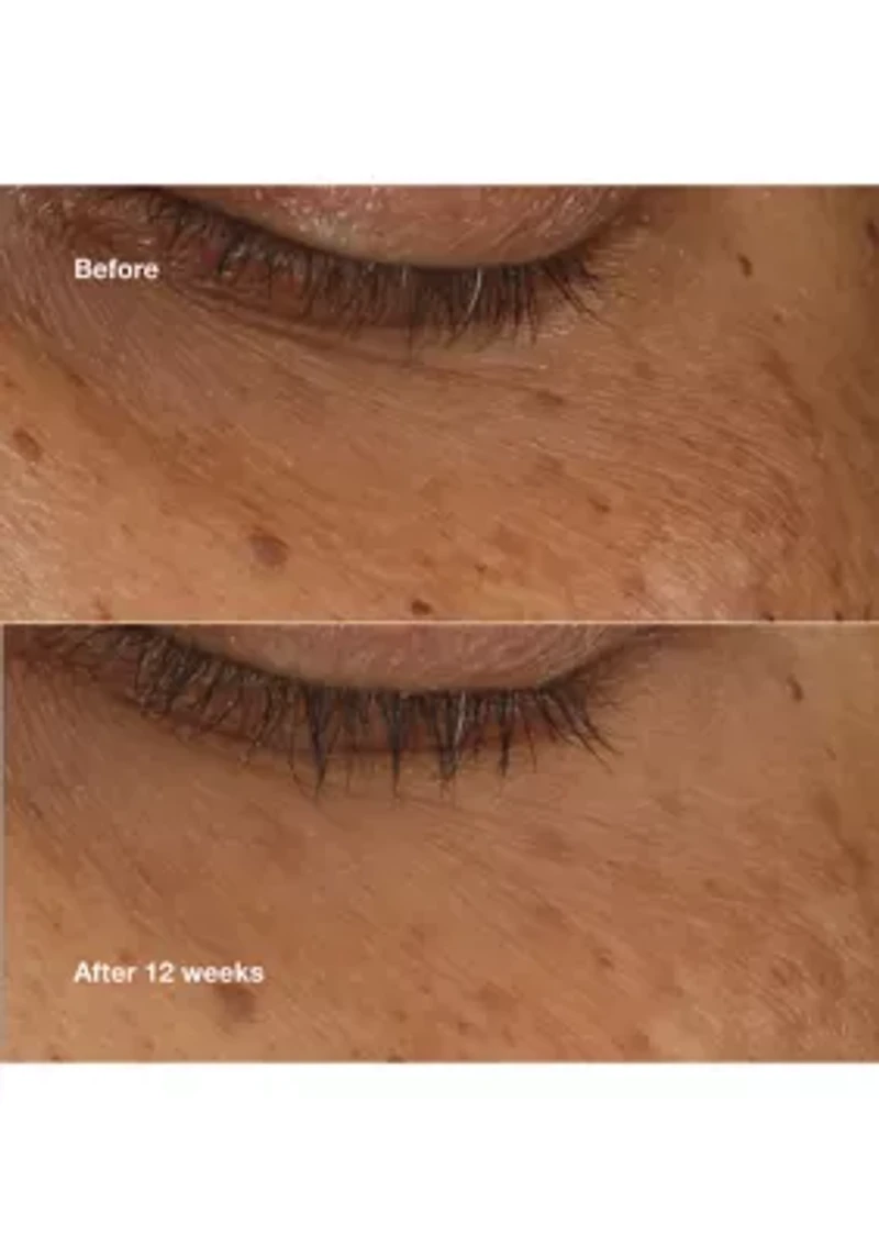 All About Eyes Brightening Serum Concentrate 