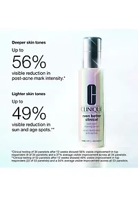 Even Better Clinical™ Dark Spot Clearing Serum with Vitamin C