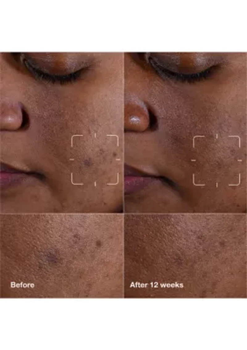 Even Better Clinical™ Dark Spot Clearing Serum with Vitamin C