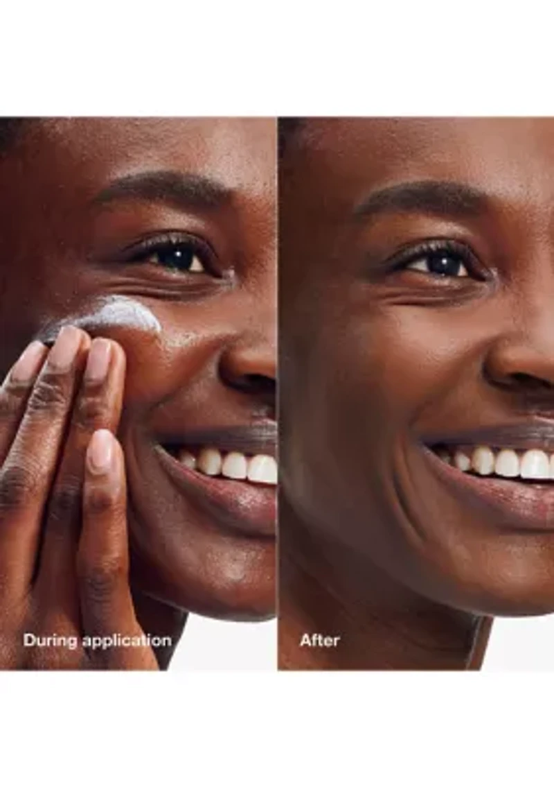 UV Solutions Mattifying Sunscreen SPF 50 with Salicylic Acid