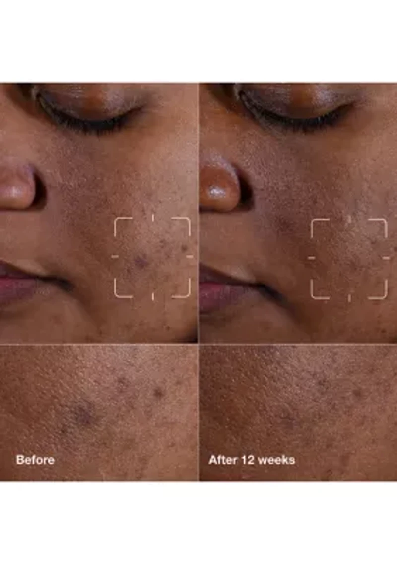 Mini Even Better Skincare Kit - $51 Value!