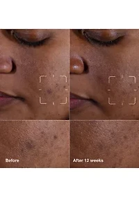 Mini Even Better Skincare Kit - $51 Value!