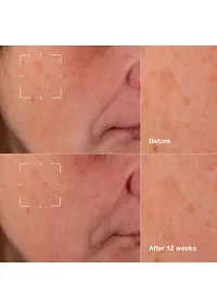 Mini Even Better Skincare Kit - $51 Value!