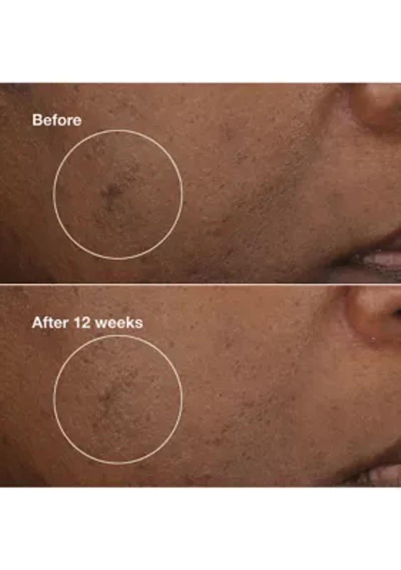 Mini Even Better Skincare Kit - $51 Value!