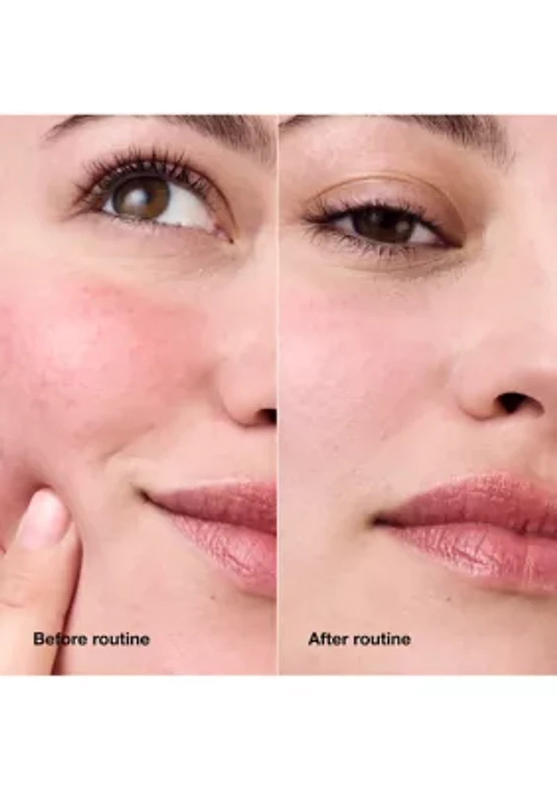 Redness Relief Skincare Set - $48 Value!