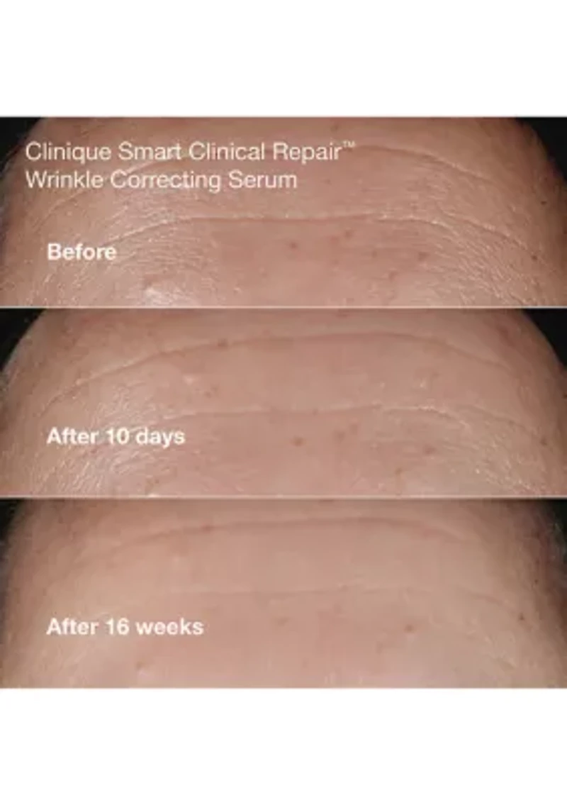 Anti - Aging Routine Mini Smart Clinical Repair Skincare Set - $81 Value!