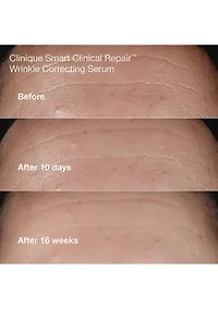 Anti - Aging Routine Mini Smart Clinical Repair Skincare Set - $81 Value!