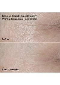 Anti - Aging Routine Mini Smart Clinical Repair Skincare Set - $81 Value!