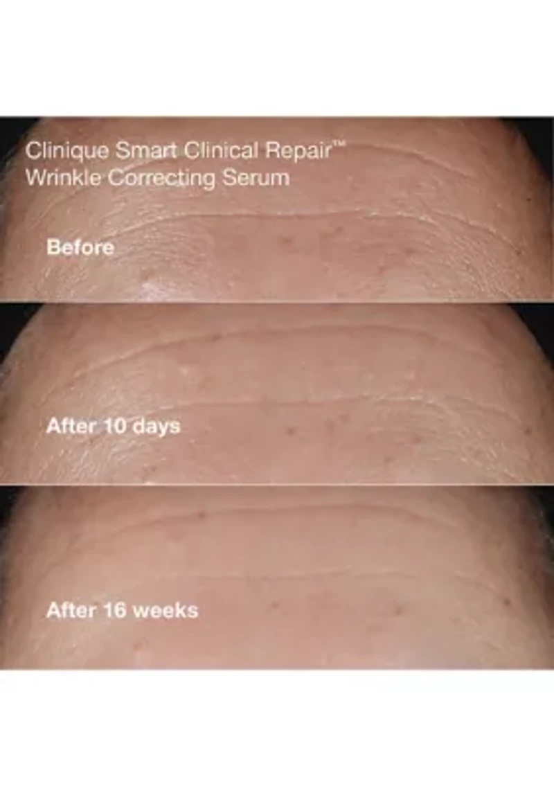 Wrinkle Fighting Routine Anti-Aging Skincare Gift Set - $129 Value!