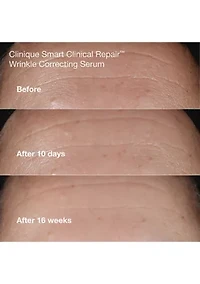 Wrinkle Fighting Routine Anti-Aging Skincare Gift Set - $129 Value!