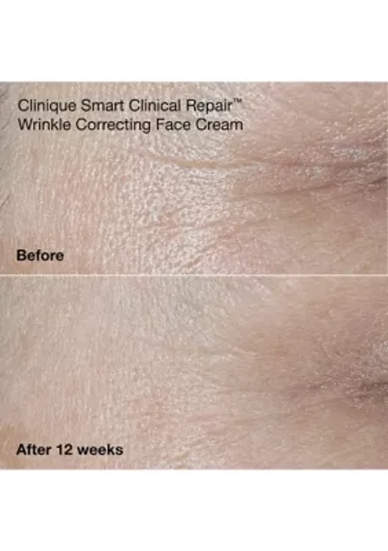 Wrinkle Fighting Routine Anti-Aging Skincare Gift Set - $129 Value!