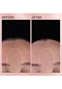 Retinol + HPR Ceramide Capsules Rapid Skin Renewing Serum