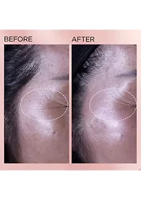 Retinol + HPR Ceramide Capsules Rapid Skin Renewing Serum