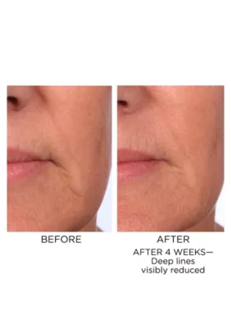 Prevage Progressive Renewal Treatment
