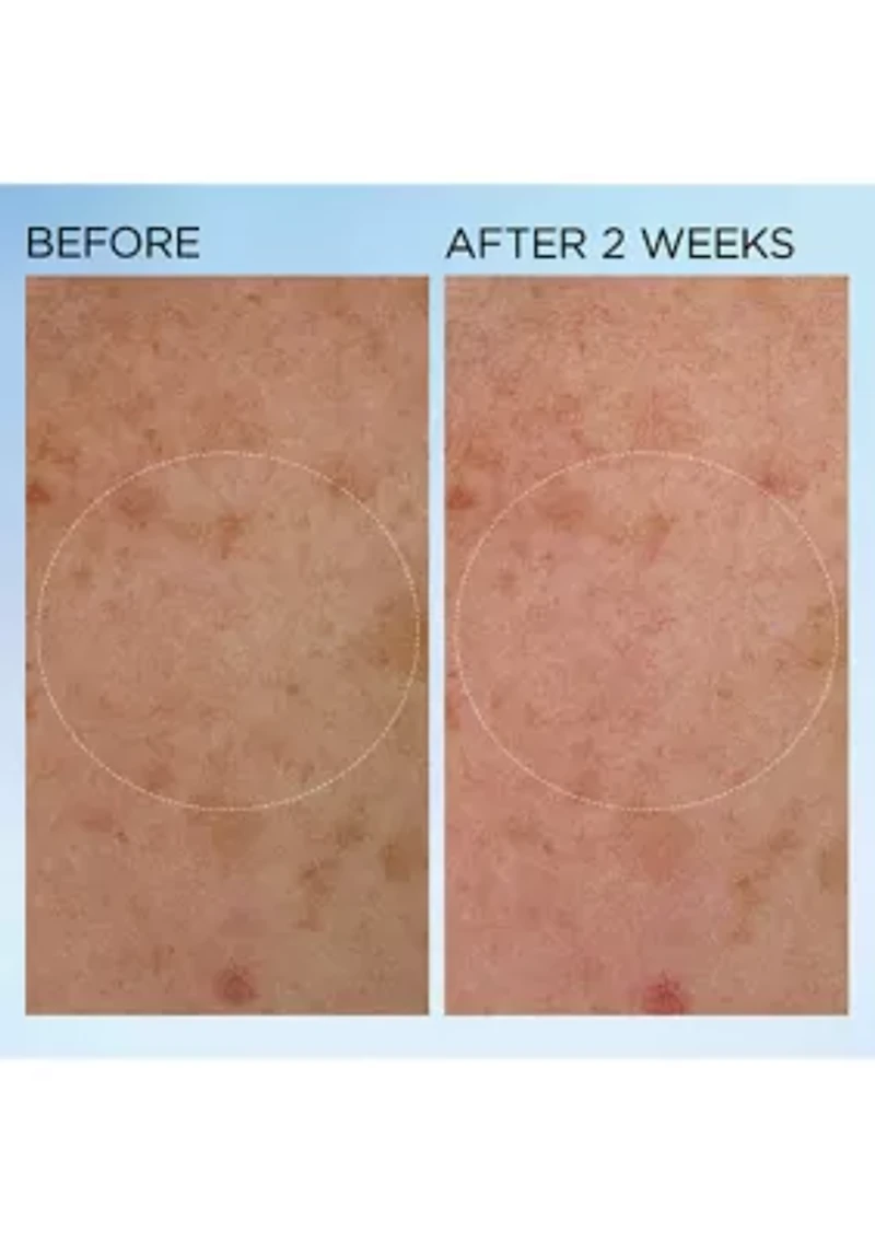 Visible Brightening Clearly Radiant Bounce Cream