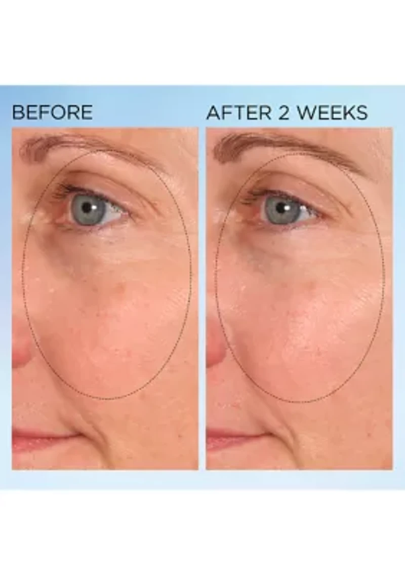 Visible Brightening Clearly Radiant Spot Correcting Capsules