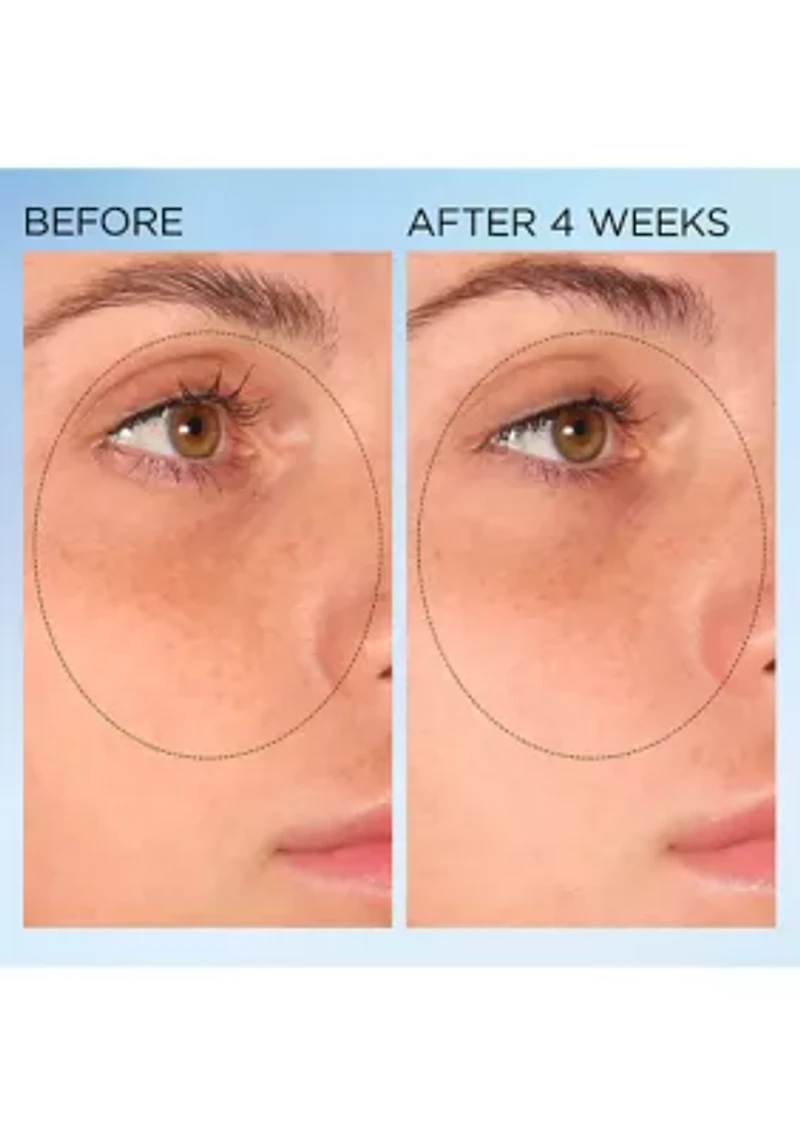 Visible Brightening Clearly Radiant Spot Correcting Capsules