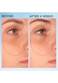 Visible Brightening Clearly Radiant Spot Correcting Capsules