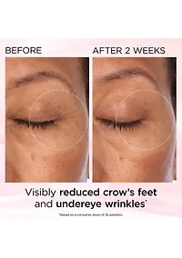 Retinol + HPR Ceramide Capsules Rapid Skin Renewing Eye Cream 