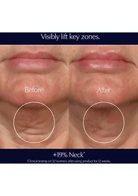 Perfectionist Pro Rapid Firm + Lift Serum with Hexapeptides