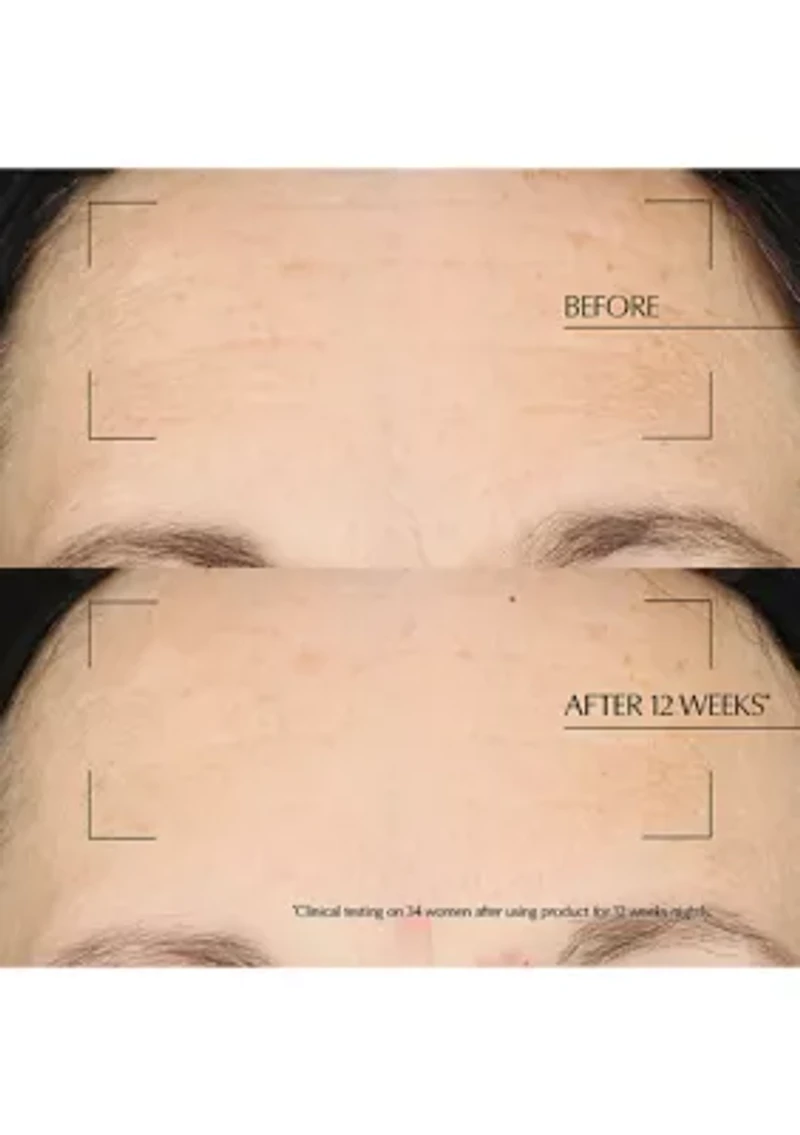 Advanced Night Repair Moisturizing Overnight Treatment with Hyaluronic Acid