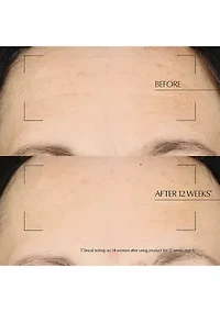 Advanced Night Repair Moisturizing Overnight Treatment with Hyaluronic Acid