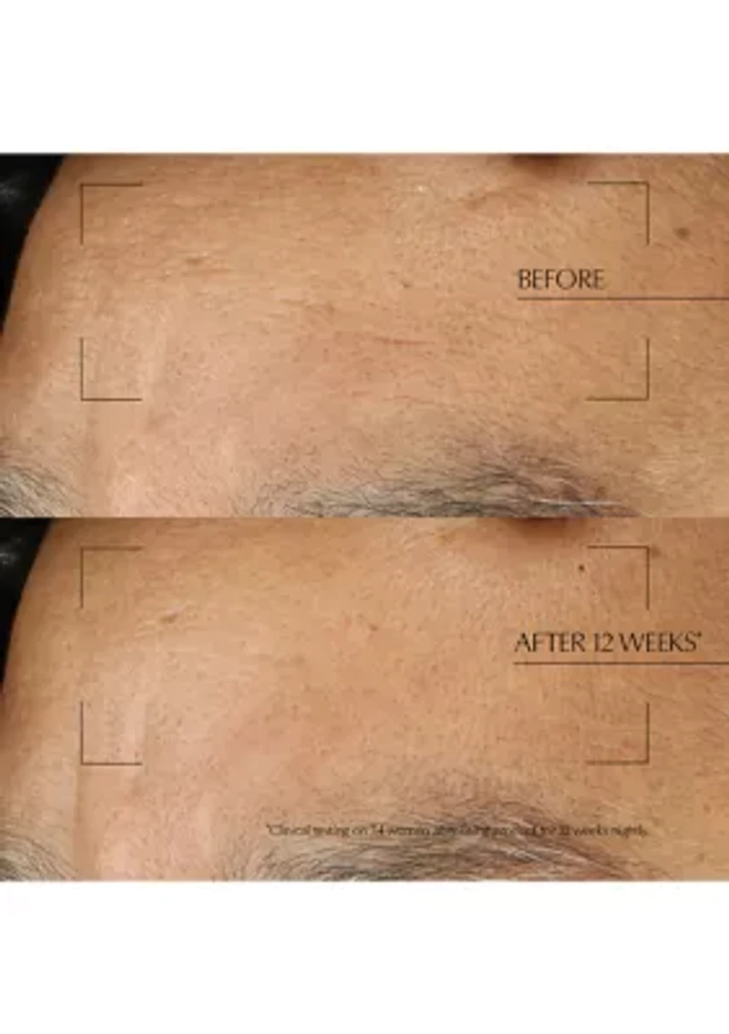 Advanced Night Repair Moisturizing Overnight Treatment with Hyaluronic Acid