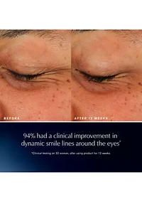 Advanced Night Repair Eye Lift + Sculpt Eye Cream