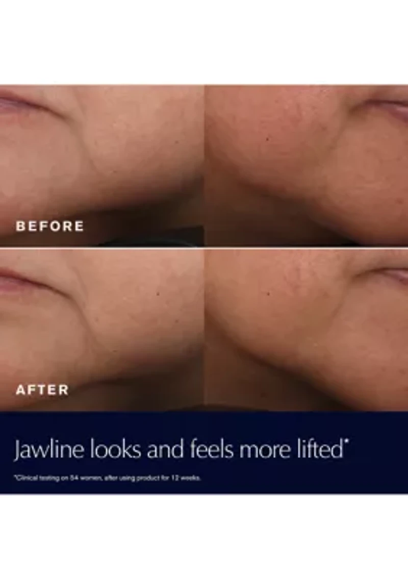 Revitalizing Supreme+ Moisturizer Refill Skincare Gift Set