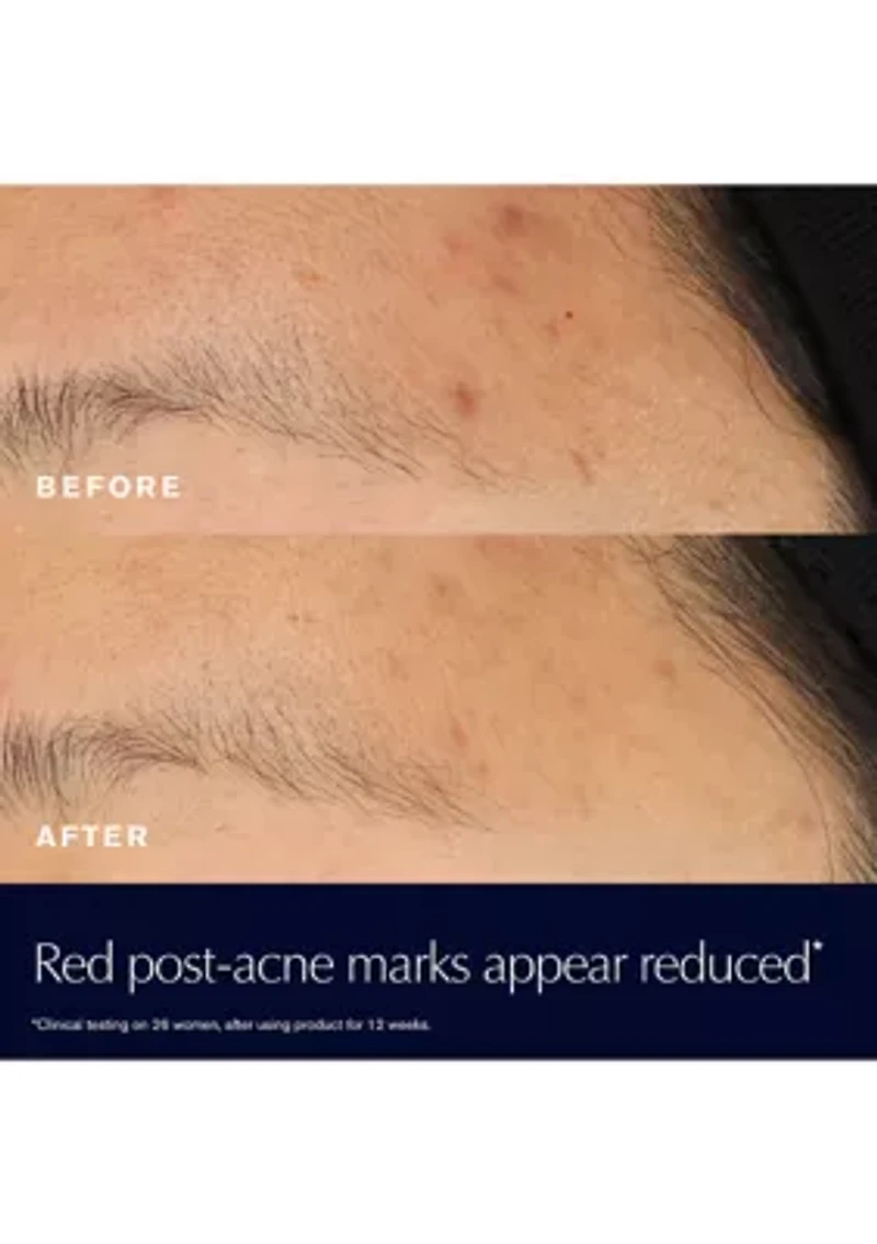 Advanced Night Repair Rescue Solution Serum with 15% Bifidus Ferment
