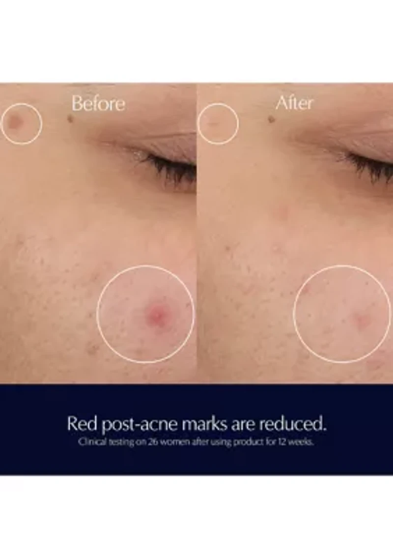 Advanced Night Repair Rescue Solution Serum with 15% Bifidus Ferment